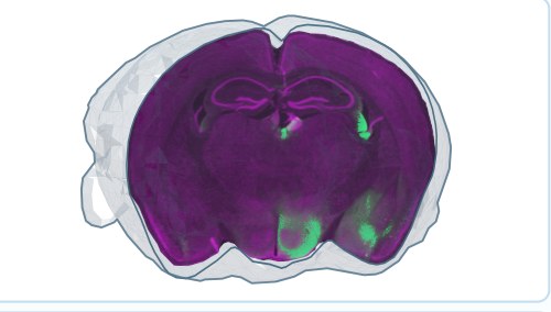 NeuroFlow 3D brain quantification